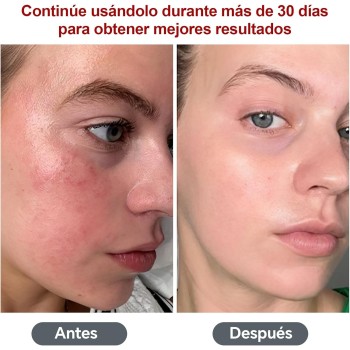 Lámpara Luz Roja,Lámpara Infrarrojos 660nm y 850nm,Lámpara de Luz Roja de 200 LED con Temporizador,luz Infrarroja para Rostro,